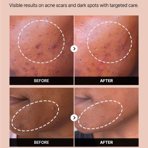 COSRX Alpha-Arbutin 2 Discoloration Care Serum - White - Picture 9 of 9